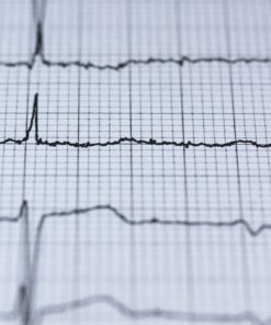 心臟檢查 – ECG 靜態心電圖