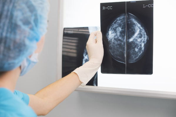 Mammogram x-ray