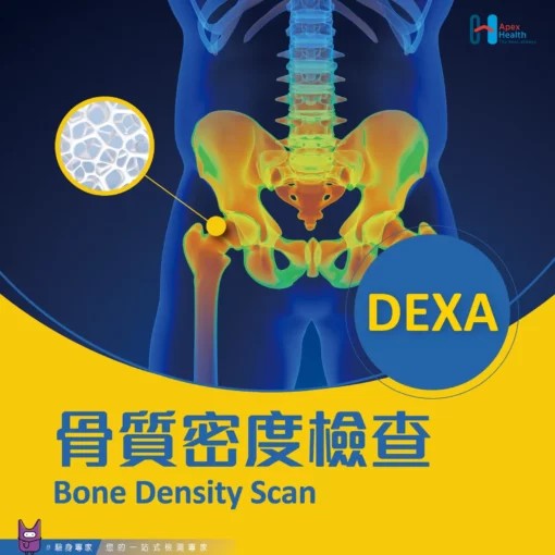 骨質密度檢查 (DEXA)