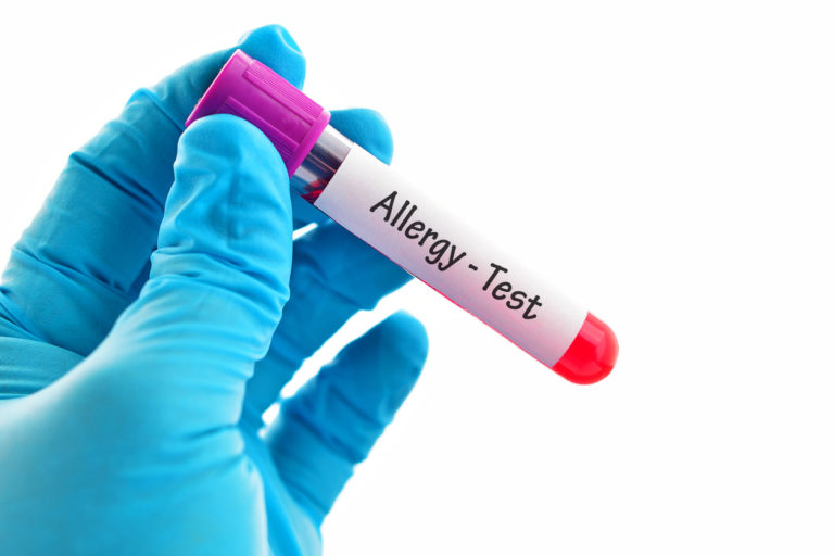 Allergy test 過敏檢測