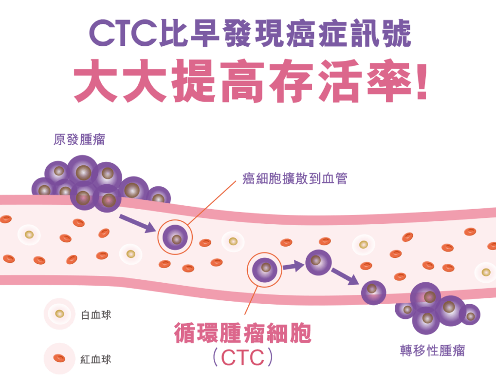 CTC癌症訊號，大大提高存活率