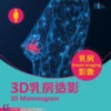 3D乳房造影
