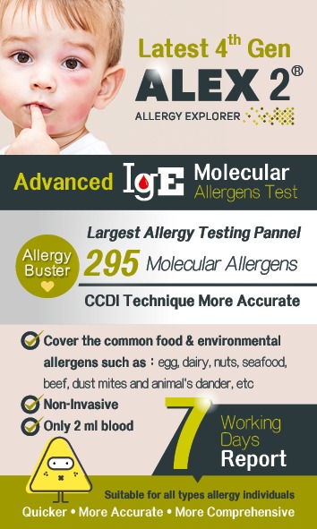 IgE Alex2 Allergy Test_EN_709x1181_v2