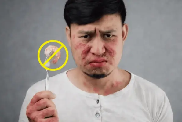 孖潤腸、周身痕、出紅疹 IgE Alex3 敏感測試 - ApexHealth