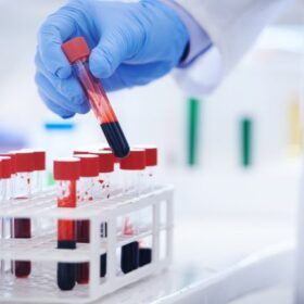 Blood test