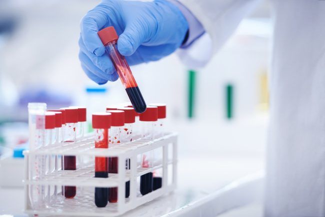 Blood test